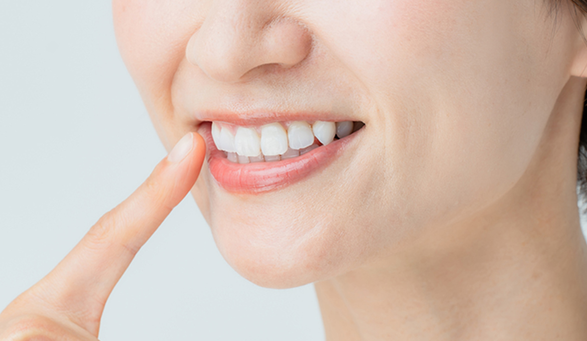 ホワイトニング